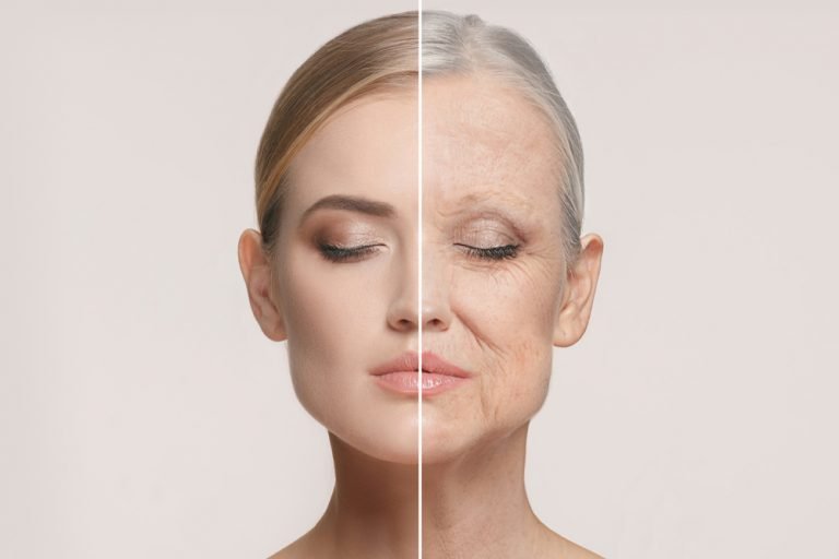 lipofilling del viso torino