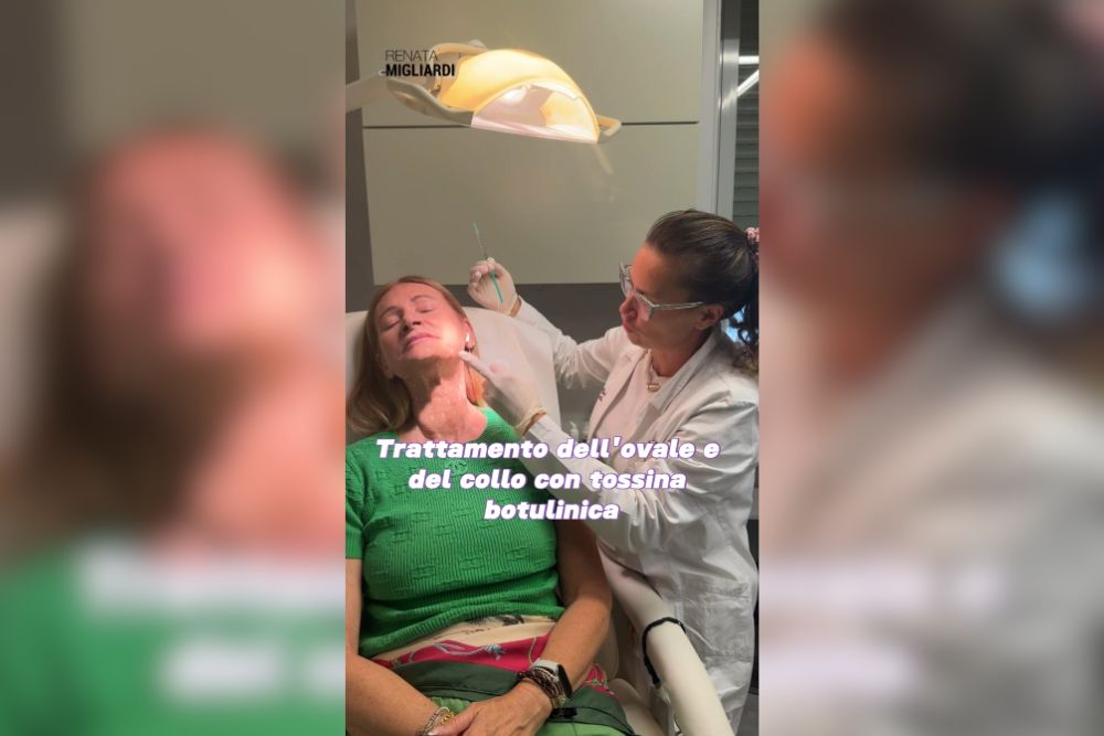 Trattamento dell’ovale e del collo con tossina botulinica