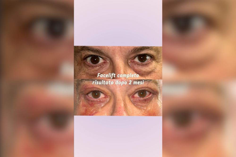 Anche agli uomini non piacciono le borse sotto gli occhi