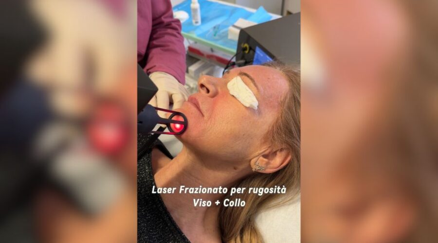 Dammi 2 Minuti Ti Mostro Come Cancellare 10 Anni dal Viso