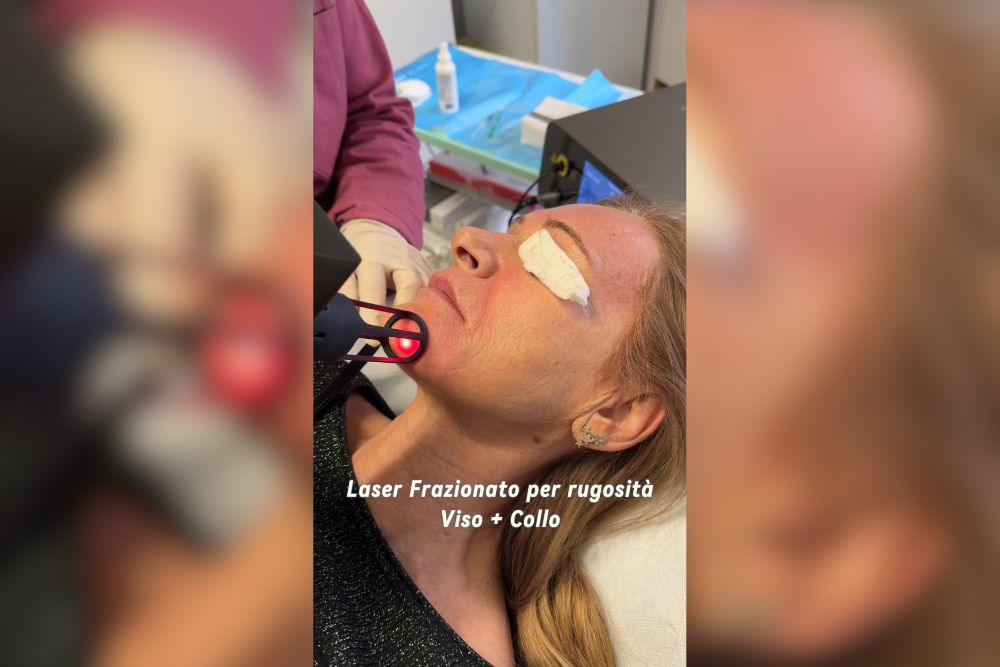 Dammi 2 Minuti Ti Mostro Come Cancellare 10 Anni dal Viso