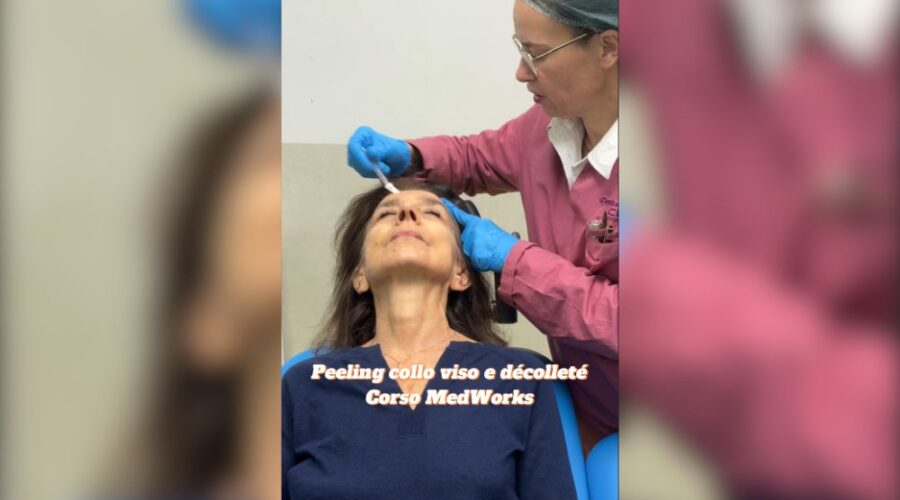 Peeling Chimico Tecnica e Segreti per Risultati Sicuri