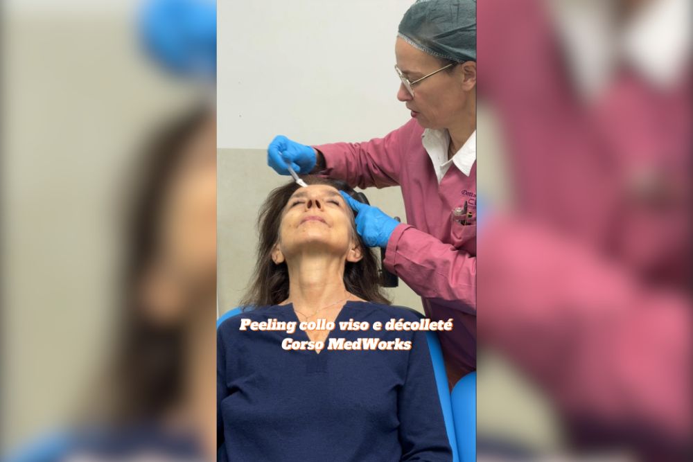 Peeling Chimico Tecnica e Segreti per Risultati Sicuri